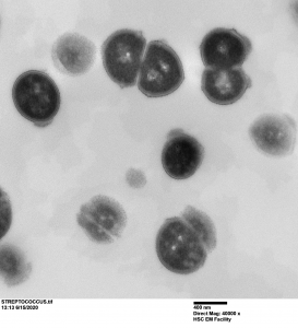 TEM of streptococcus with 800 nm scale bar.
