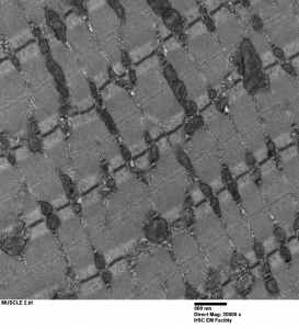 Greyscale TEM image of muscle with 800 nm scale bar.