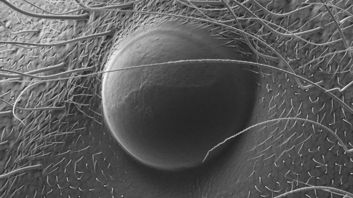 High magnification SEM image of unknown object