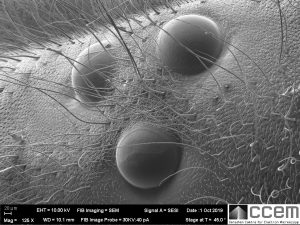 SEM image of insect body part.